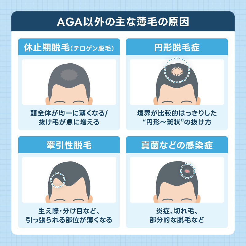 AGA以外の薄毛 原因