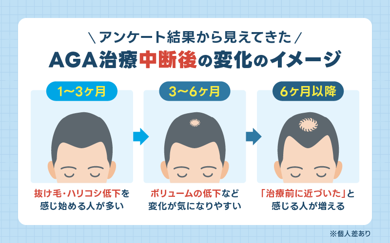 AGA治療をやめると 変化のイメージ