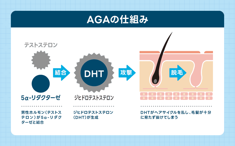 AGA 進行する仕組み