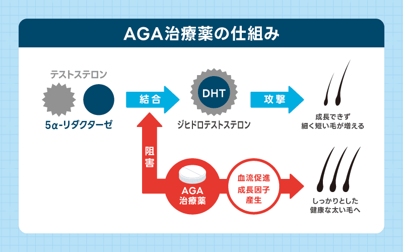 AGA治療 仕組み