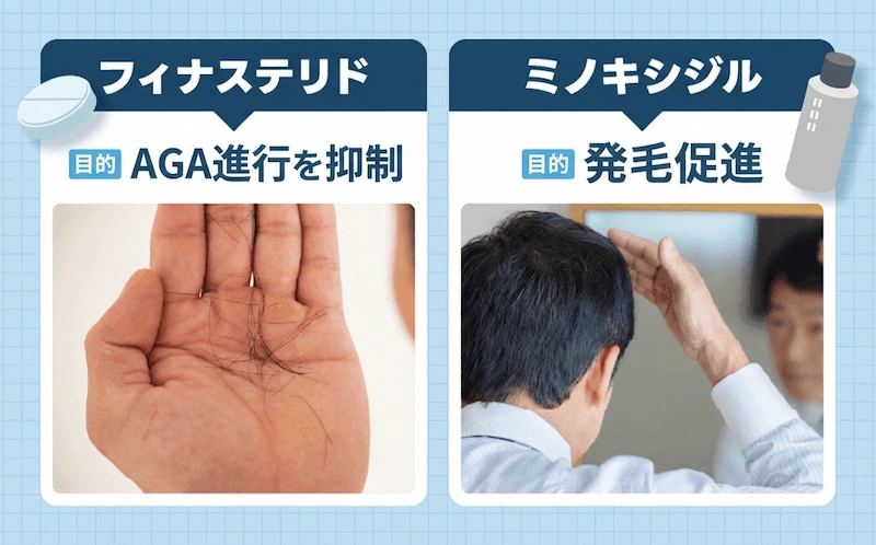 AGA治療薬 フィナステリド ミノキシジル