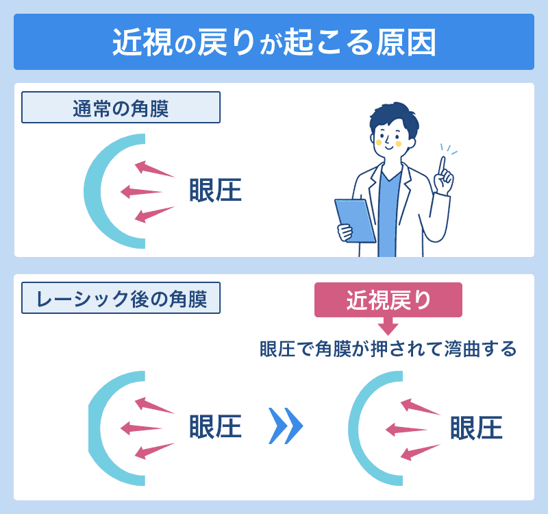 近視の戻りが起こる原因