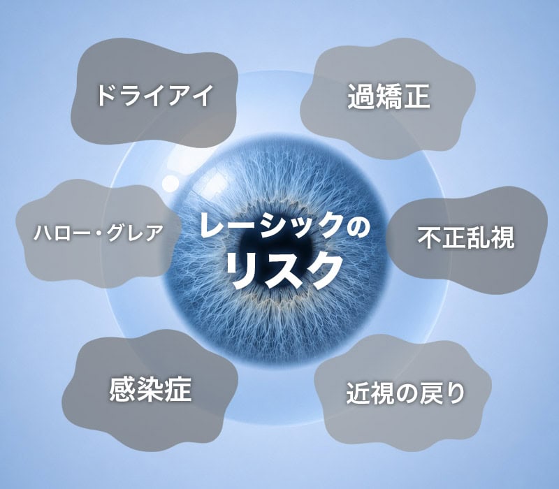 レーシック　リスク
